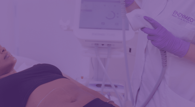 Best RF Device for Aesthetic Providers Matching Technology to Your Patient Demographic_Blog Thumbnail